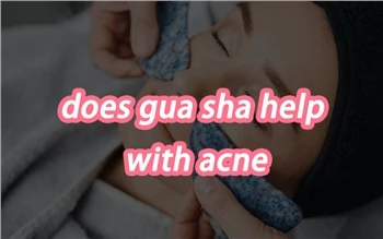 האם Gua Sha עוזר עם אקנה